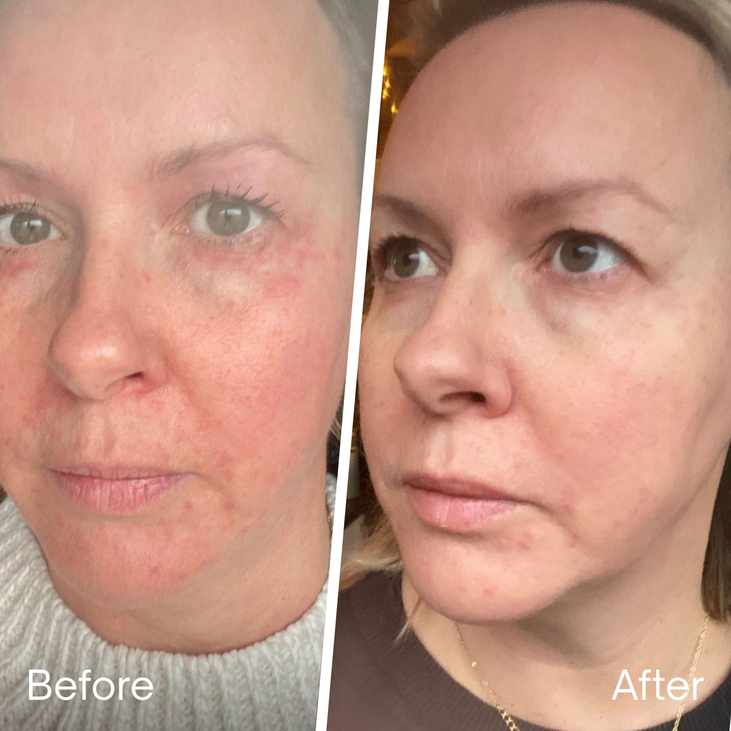 REVIVÉ 7-Light LED Therapy Mask