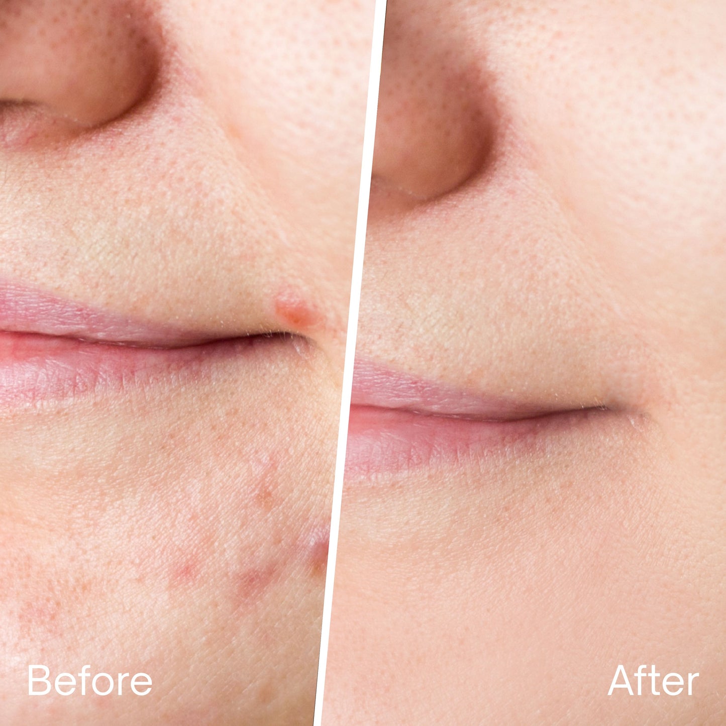 REVIVÉ 7-Light LED Therapy Mask