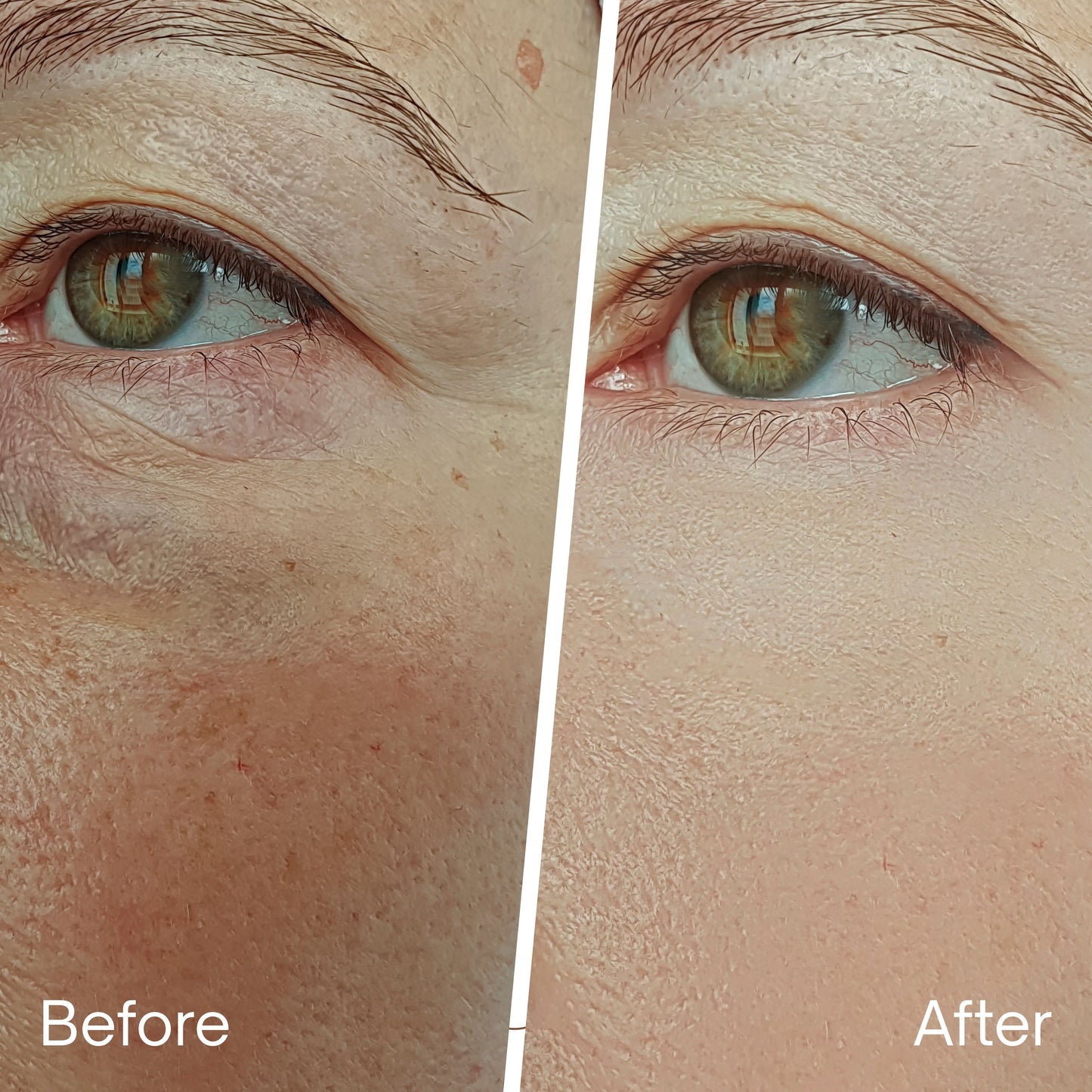 REVIVÉ 7-Light LED Therapy Mask