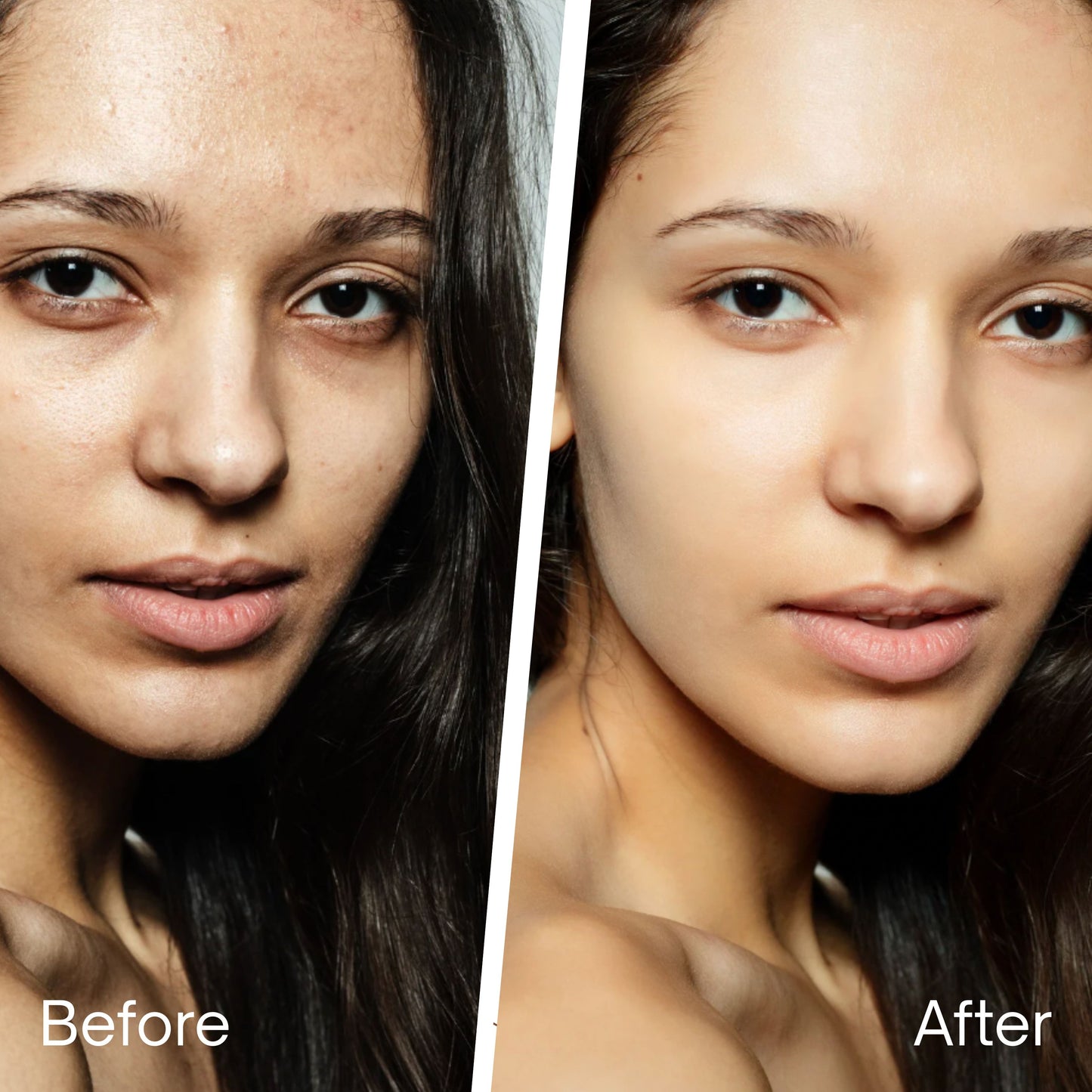 REVIVÉ 7-Light LED Therapy Mask